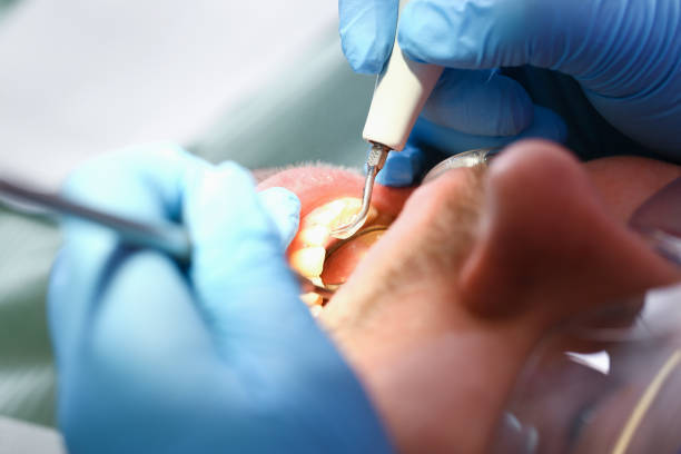 Best Emergency Broken Tooth Repair in Encinal, TX